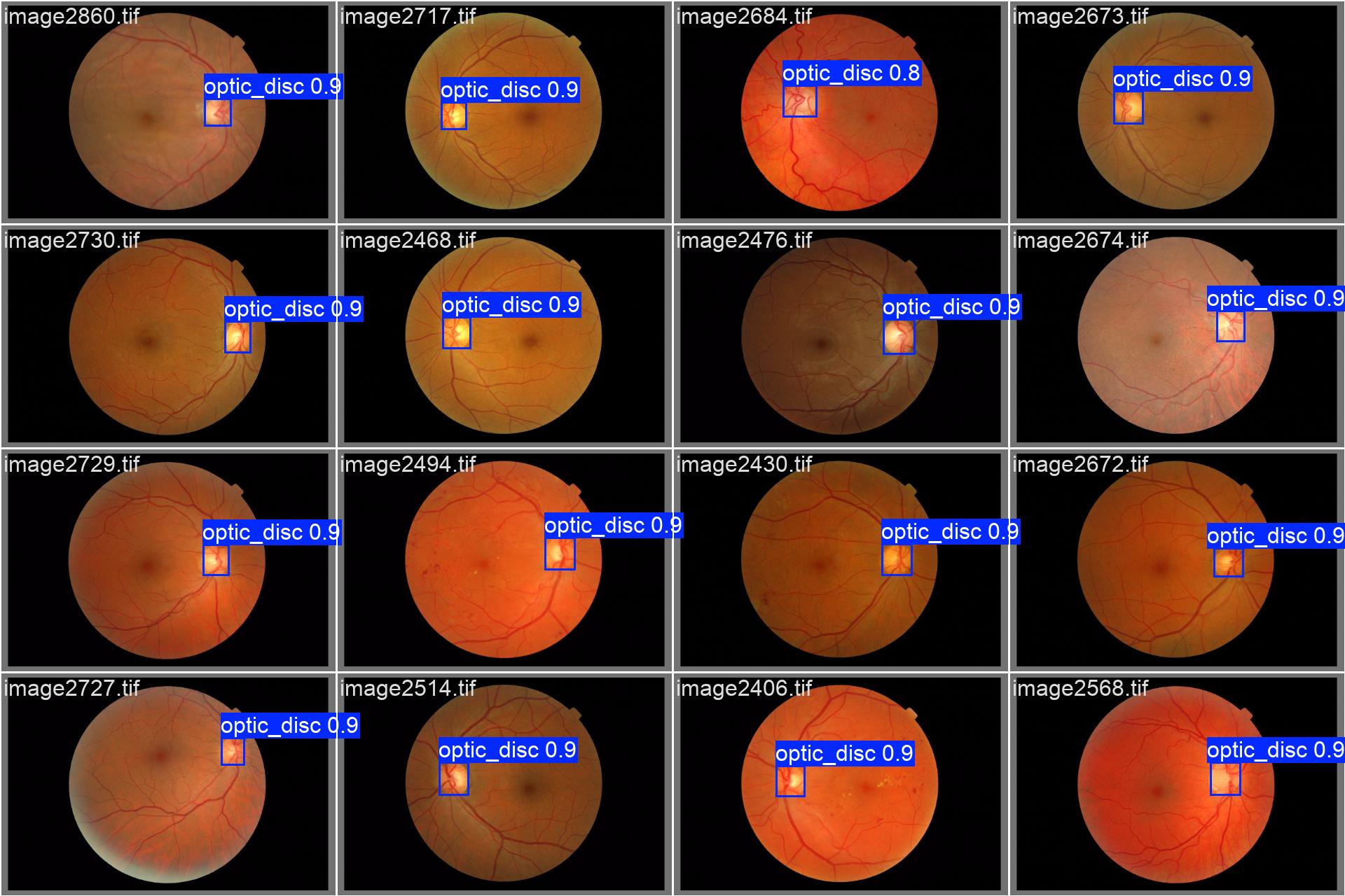 Results obtained on validation set from baseline 1