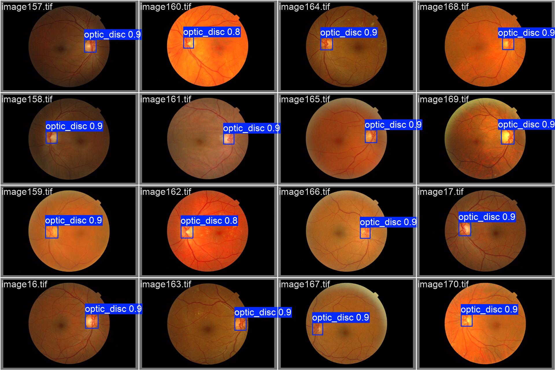 Results obtained on validation set from baseline 2